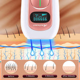 IPL Hair Removal Device Laser