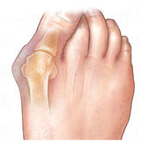 Bunion Exerciser