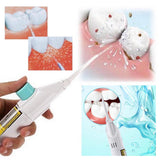 Jet Powered Floss