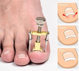 Ingrown Toenail Corrector