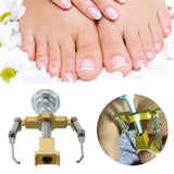 Ingrown Toenail Corrector