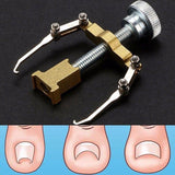 Ingrown Toenail Corrector