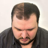 Cotton Hair Thickener