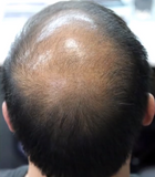 Cotton Hair Thickener