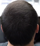 Cotton Hair Thickener