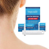 Skin Tag Remover + Top up