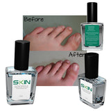 Toe Nail Softener - Direct Savings Online