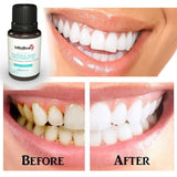 Infinitive Gum Disease Treatment Oil