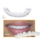 Instant Smile Veneers