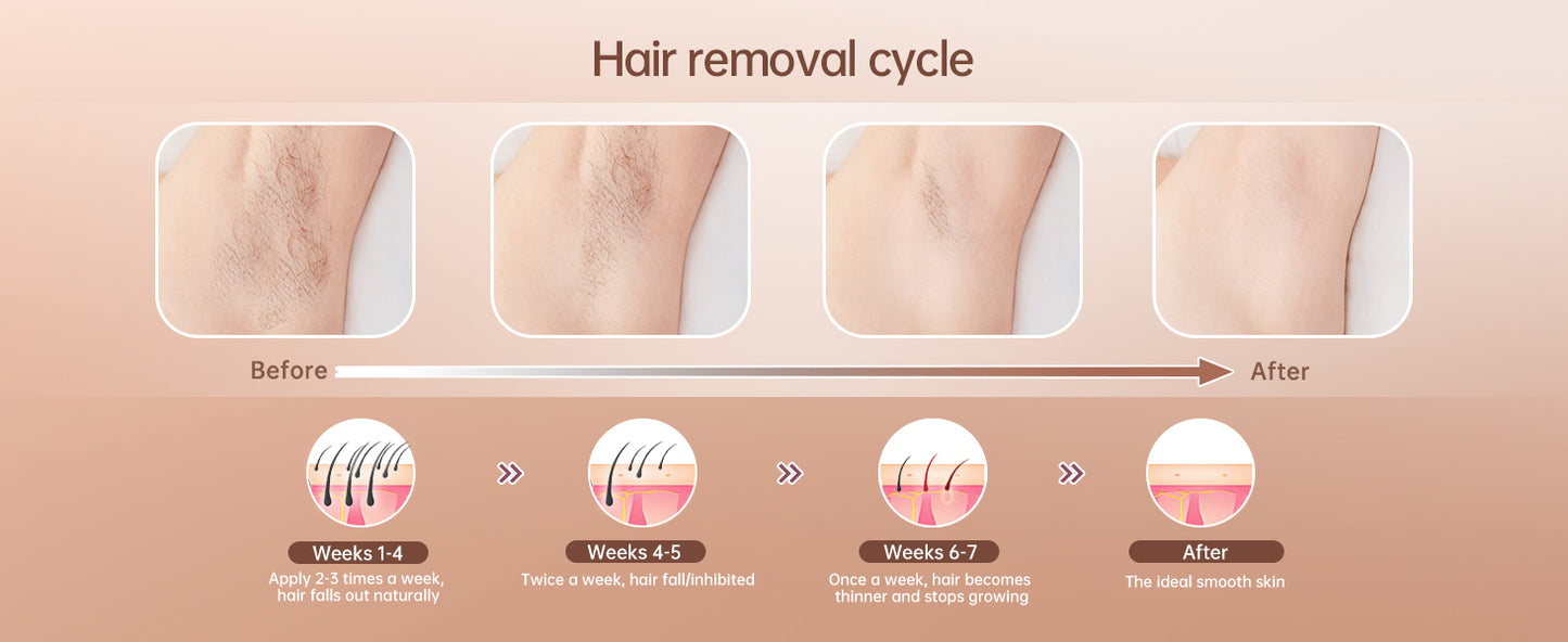 IPL Hair Removal Device Laser
