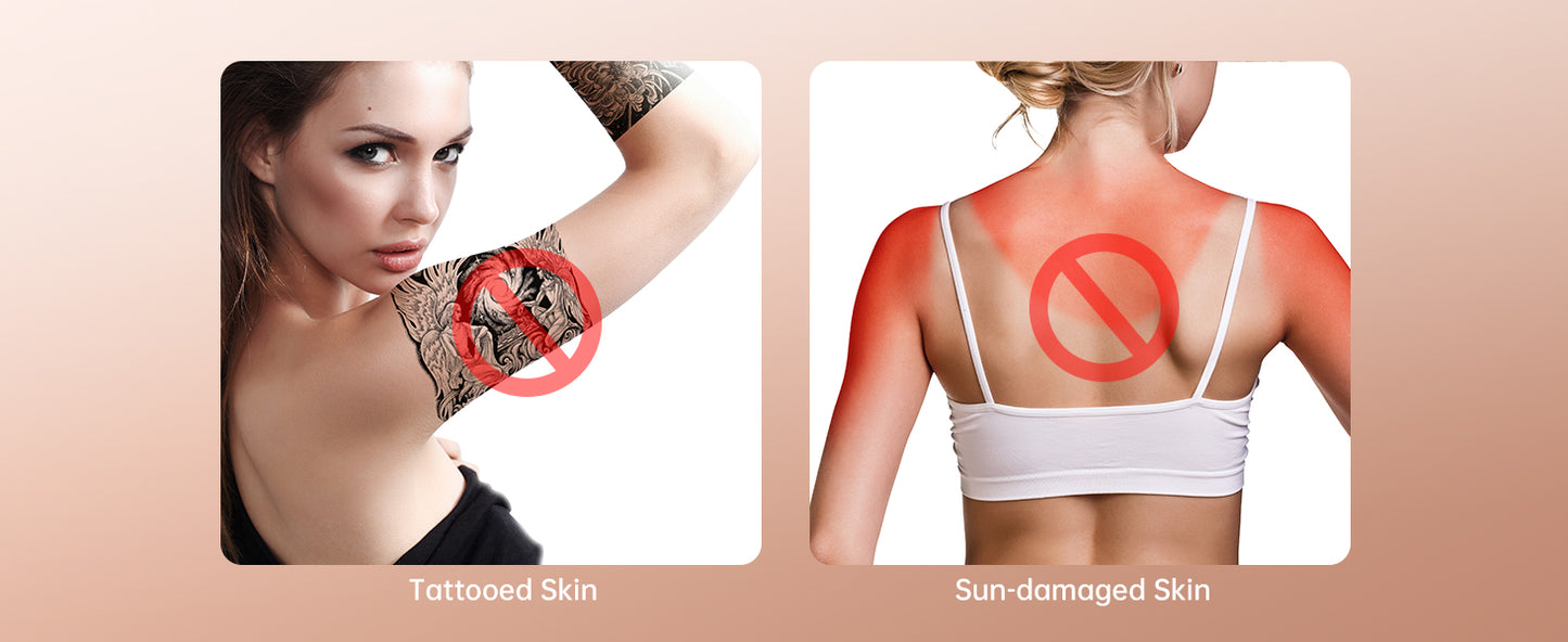 IPL Hair Removal Device Laser