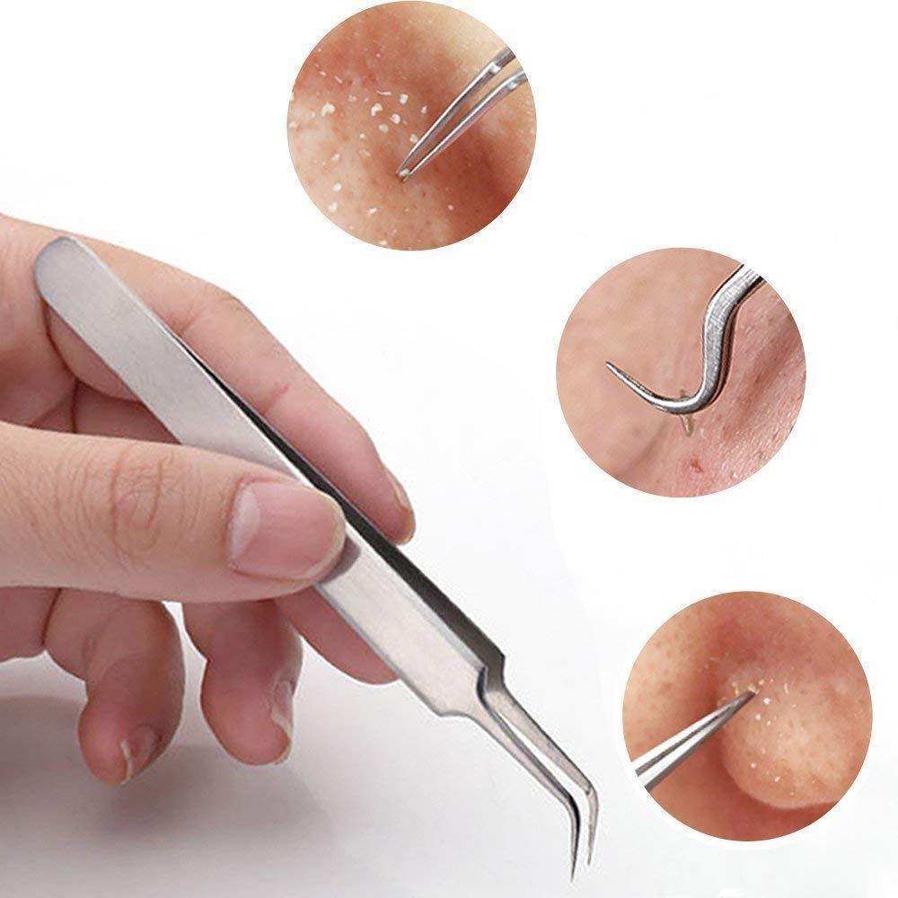 Blackhead Removal Claw