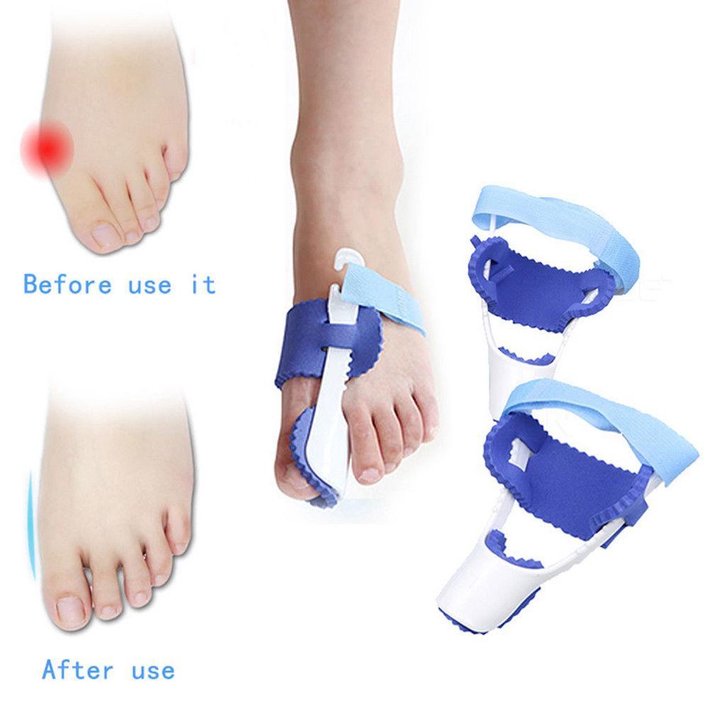 Splint Corrector Device
