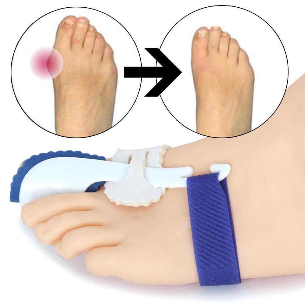 Splint Corrector Device