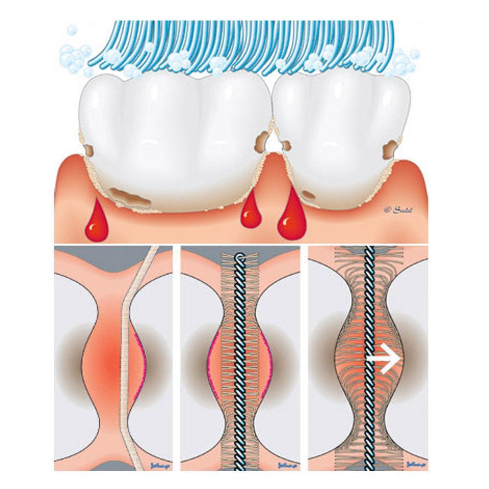Interdental Brushes