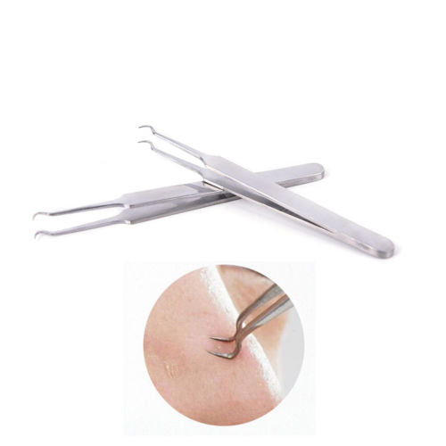 Blackhead Removal Claw 2 Pack