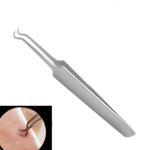 Blackhead Removal Claw 2 Pack