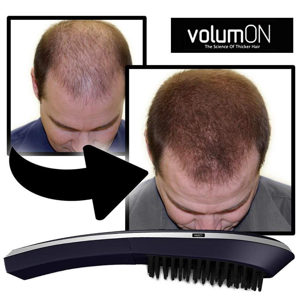 Electric Laser Massage Comb