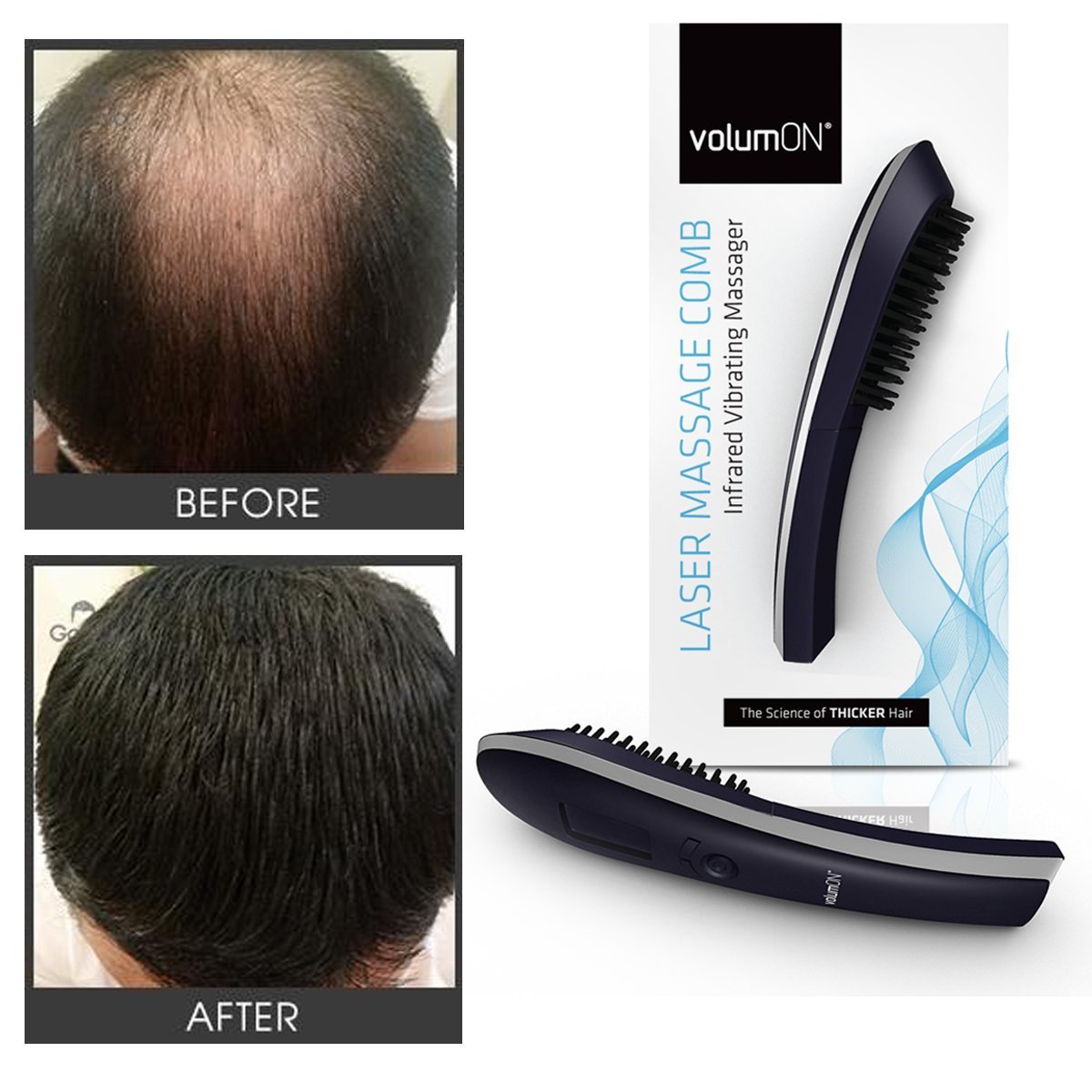 Electric Laser Massage Comb