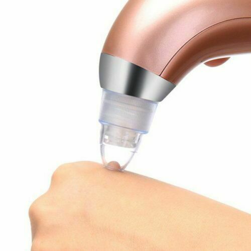Blackhead Remover Vacuum