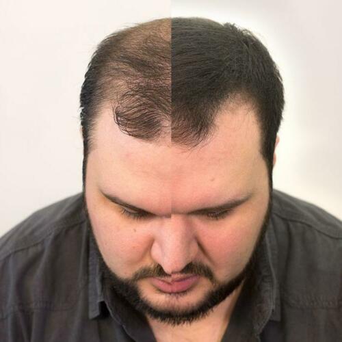 Cotton Hair Thickener