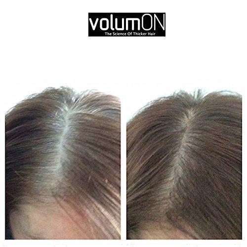 Hair Loss Concealer