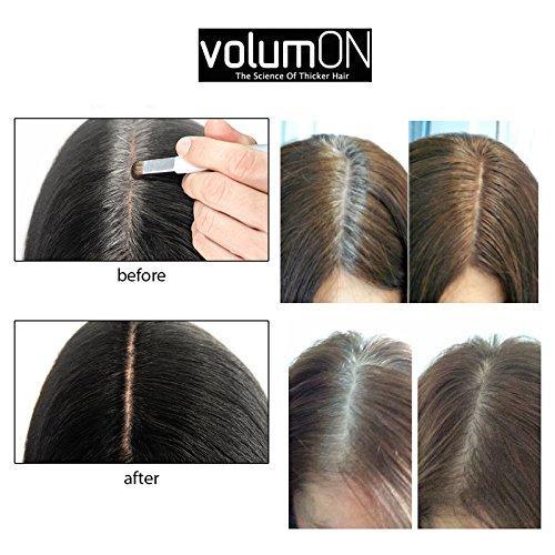 Hair Loss Concealer