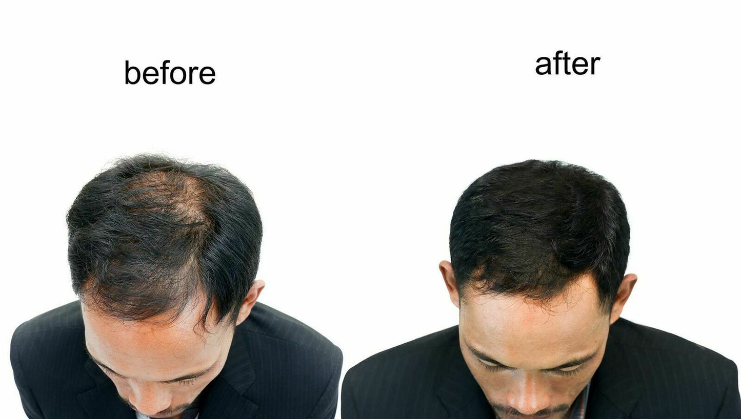 Keratin Hair Thickener