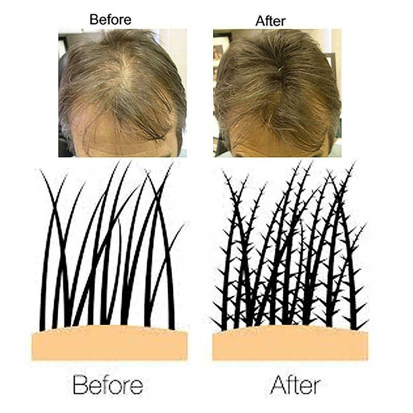 Keratin Hair Thickener
