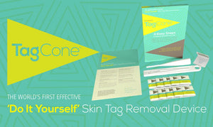 Skin Tag Removal Device