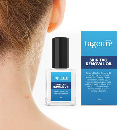 Skin Tag Removal Oil