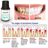 Infinitive Gum Disease Treatment Oil